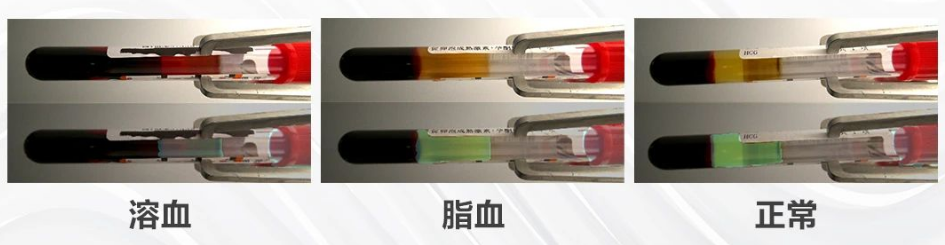 血液質量檢測.png 血液質量檢測.png